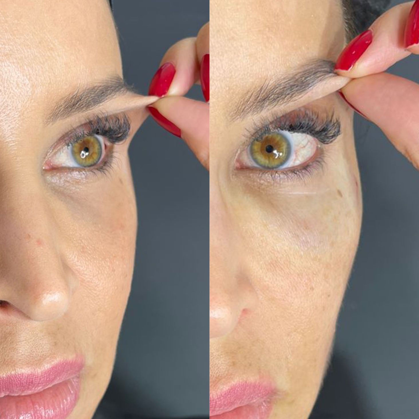 ENDOLASER Dra. Ana Flávia